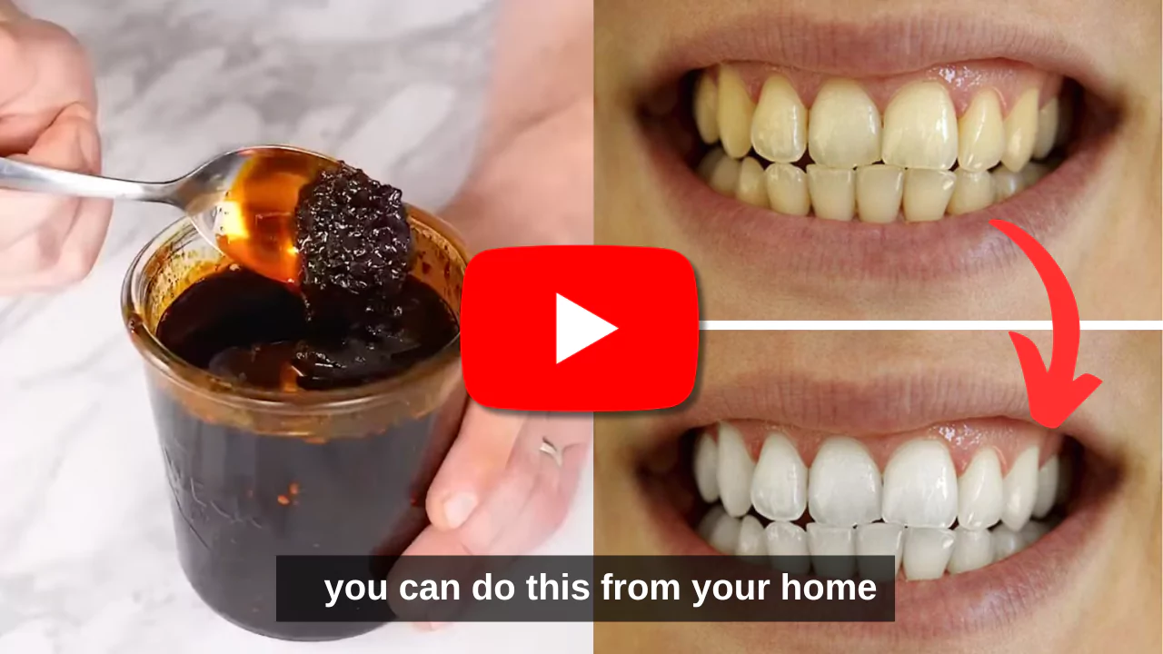 Odd Dental Tricking method